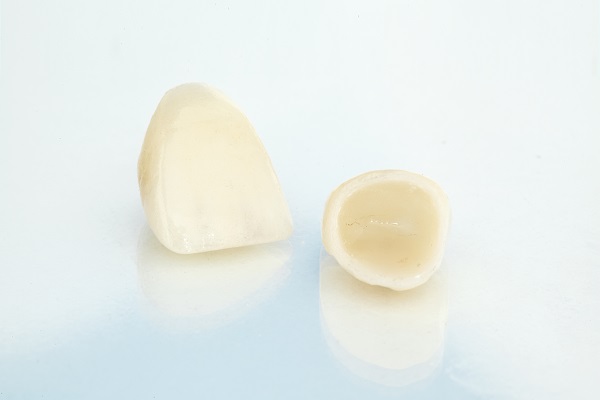 What To Do With A Loose Dental Crown