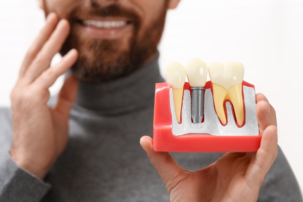 Can Dental Implants Support A Dental Bridge?