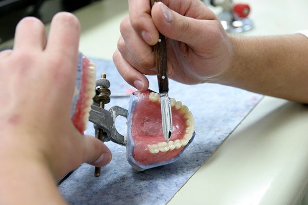 Recovery Guide After Full Mouth Reconstruction